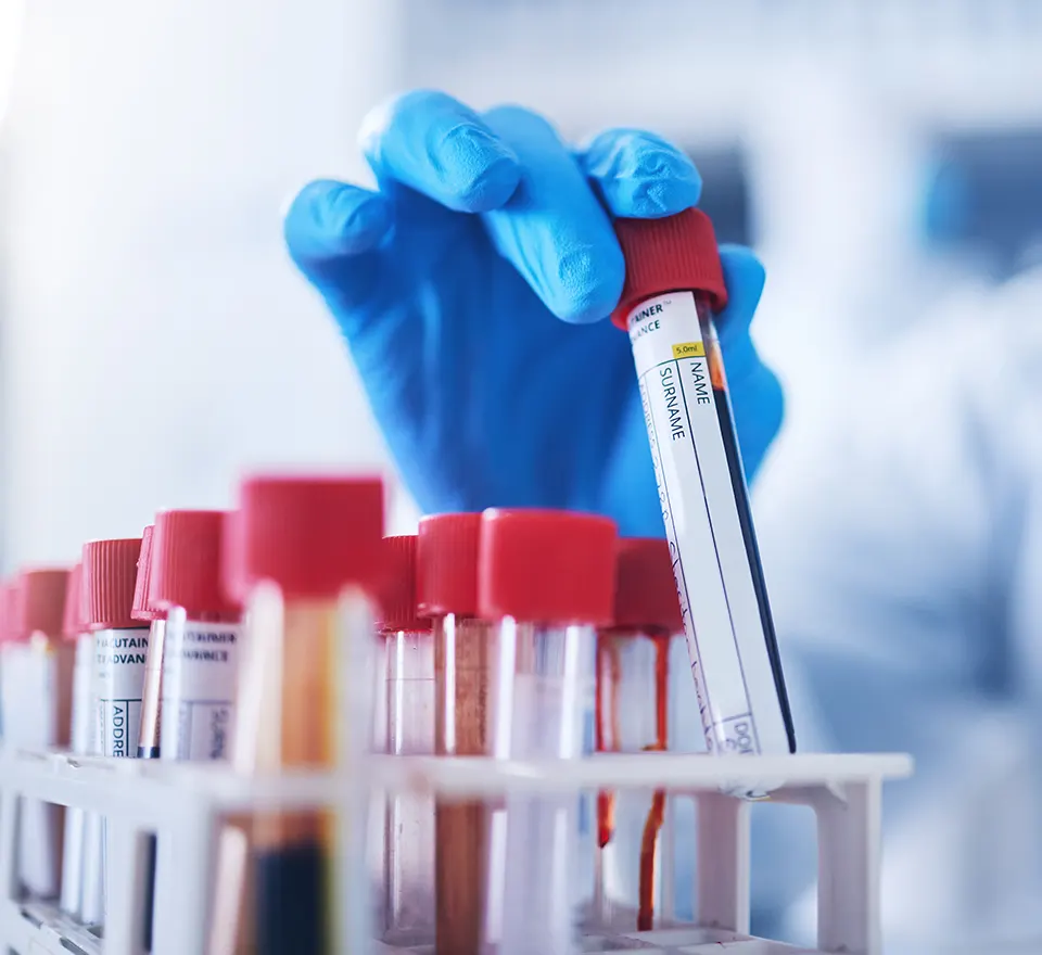 L.A.D. Laboratorio di Accertamenti Diagnostici a Roma centro si caratterizza per una gamma completa di analisi del sangue e delle urine, esami strumentali e visite specialistiche.