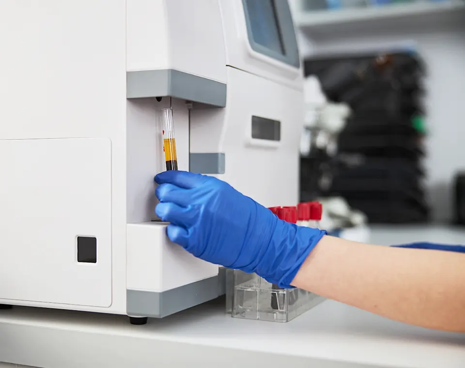 Il nostro laboratorio a Roma centro fornisce un servizio completo di analisi del sangue e delle urine sia per normali controlli che per approfondimenti diagnostici e terapeutici.